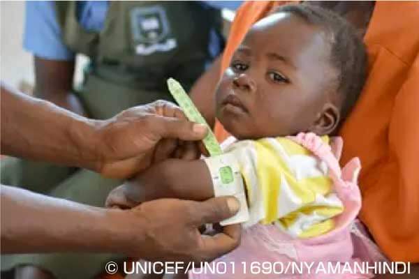 ジンバブエの保健所で診察を受ける子ども